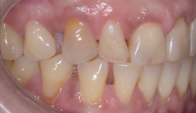 Io Sorrido - Studio Dentistico a Borgoricco