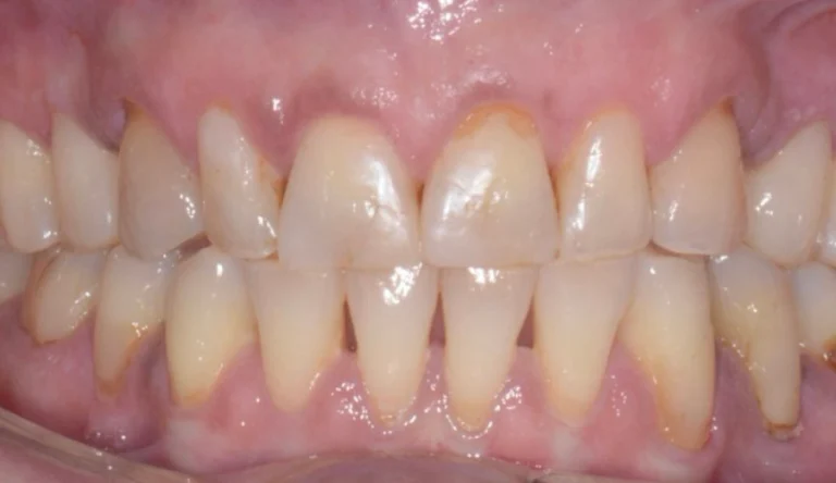Io Sorrido - Studio Dentistico a Borgoricco