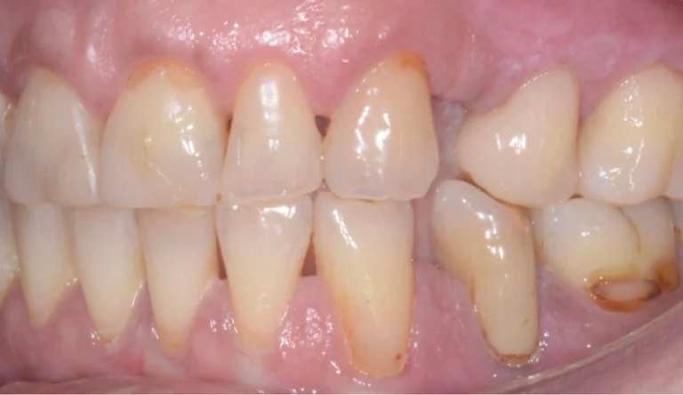 Io Sorrido - Studio Dentistico a Borgoricco