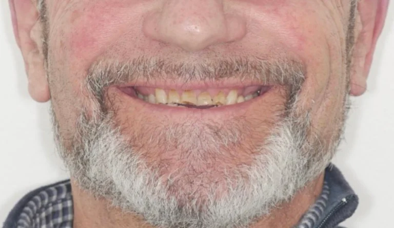 Io Sorrido - Studio Dentistico a Borgoricco