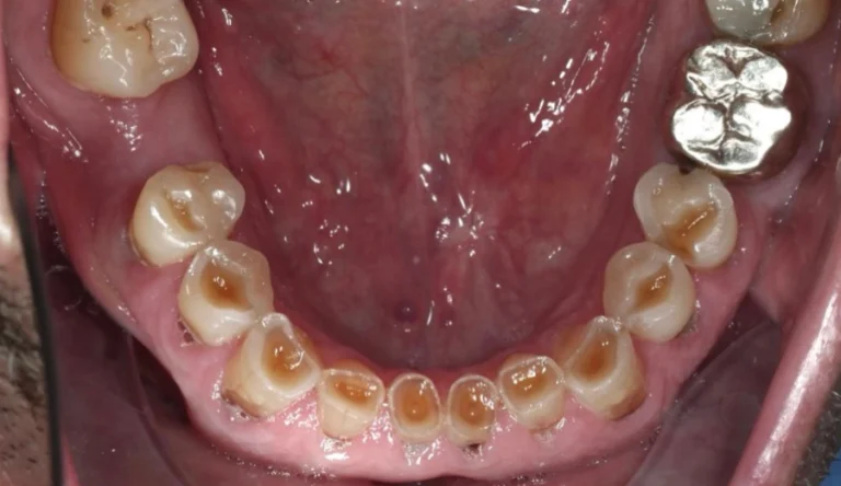 Io Sorrido - Studio Dentistico a Borgoricco
