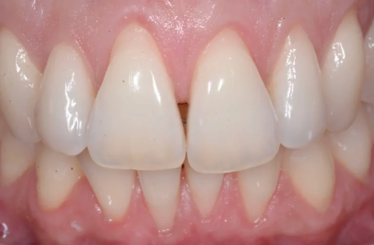 Io Sorrido - Studio Dentistico a Borgoricco