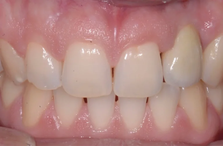 Io Sorrido - Studio Dentistico a Borgoricco
