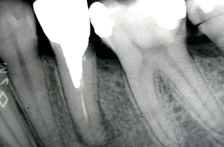 Io Sorrido - Studio Dentistico a Borgoricco