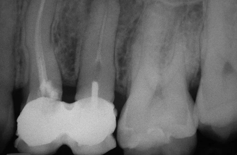 Io Sorrido - Studio Dentistico a Borgoricco