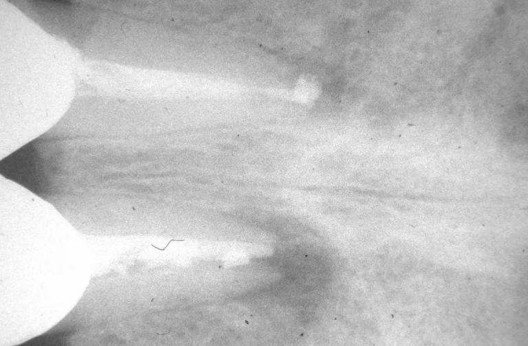 Io Sorrido - Studio Dentistico a Borgoricco