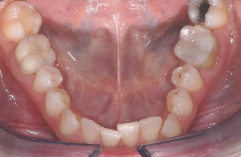 Io Sorrido - Studio Dentistico a Borgoricco