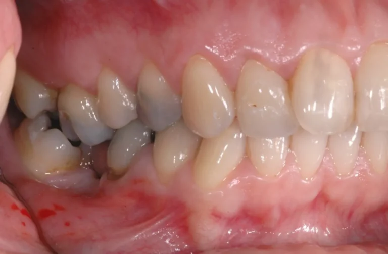 Io Sorrido - Studio Dentistico a Borgoricco