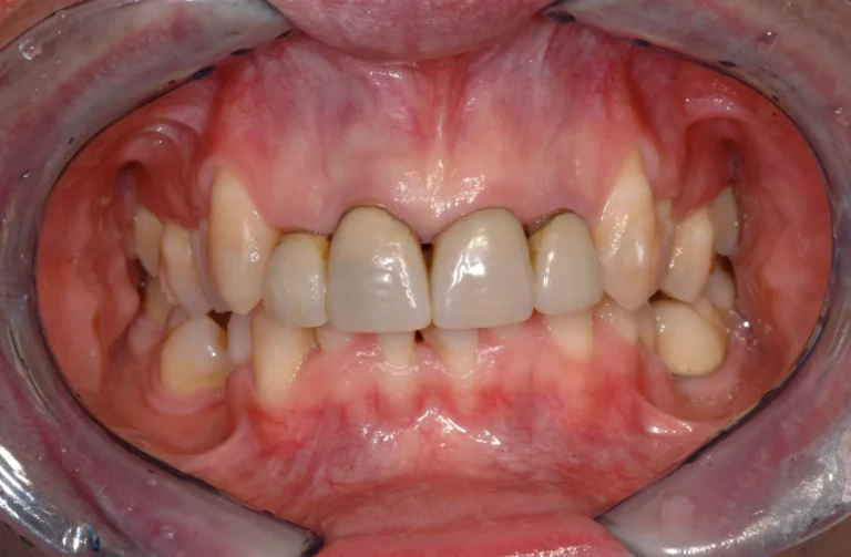 Io Sorrido - Studio Dentistico a Borgoricco
