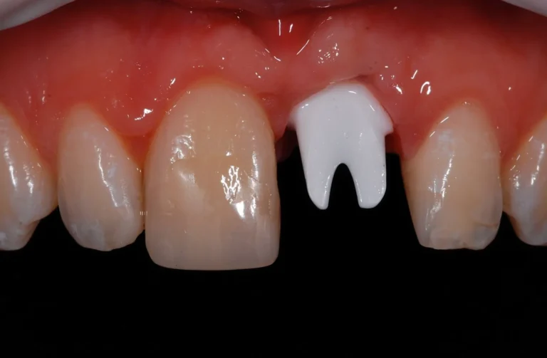 Io Sorrido - Studio Dentistico a Borgoricco