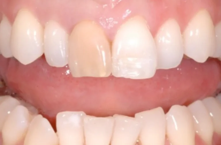Io Sorrido - Studio Dentistico a Borgoricco